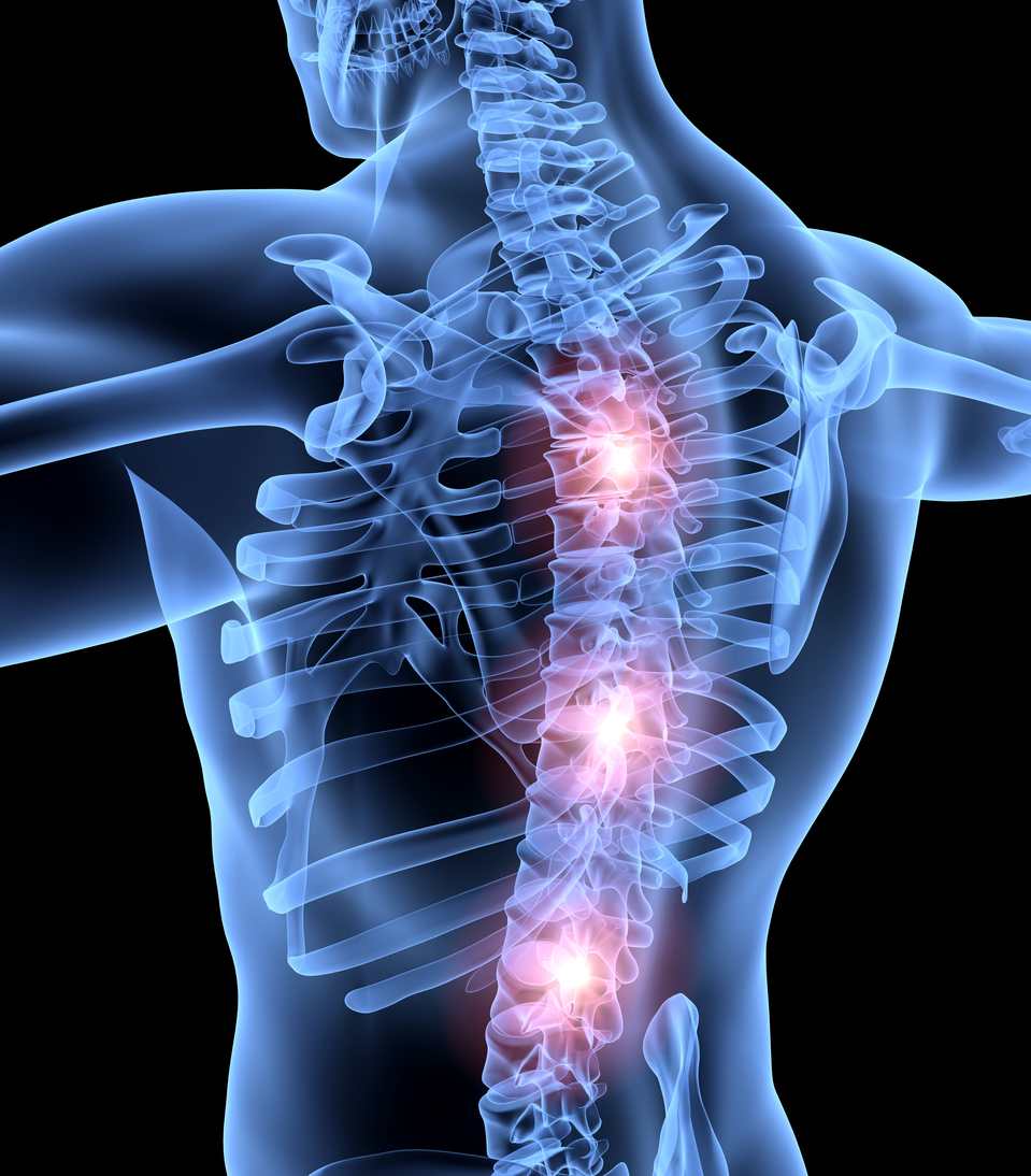 Exciting New Research Offers Hope for Spinal Cord Injury Patients